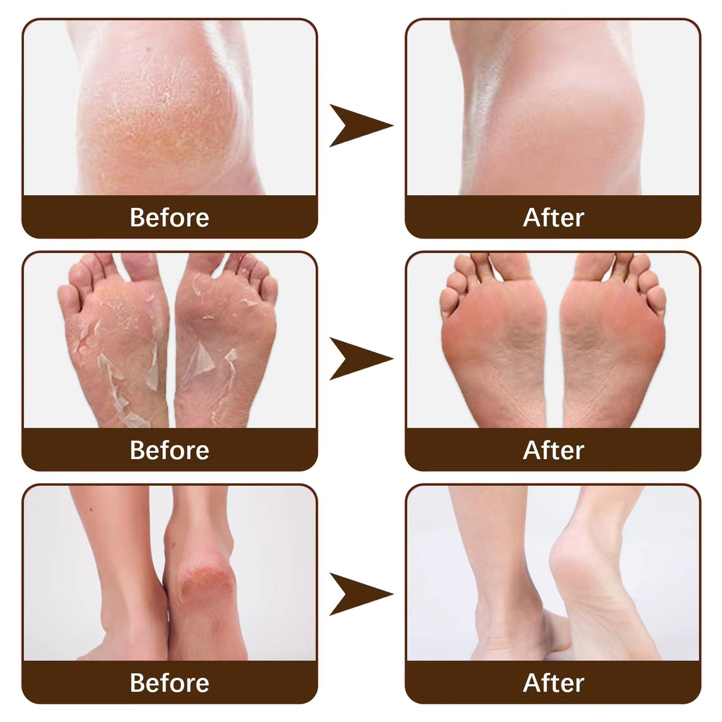 Exfoliator Foot Cream Dead Skin Remover Heel Crack Repair Treatment Moisturizing Hand Feet Anti-Drying Cracked Care Foot Mask