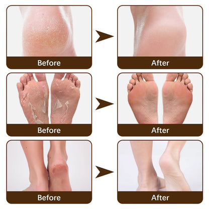 Exfoliator Foot Cream Dead Skin Remover Heel Crack Repair Treatment Moisturizing Hand Feet Anti-Drying Cracked Care Foot Mask